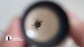 Челябинская область снова попала в лидеры по числу укусов клещей.